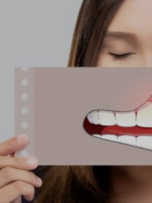 Gum Contouring